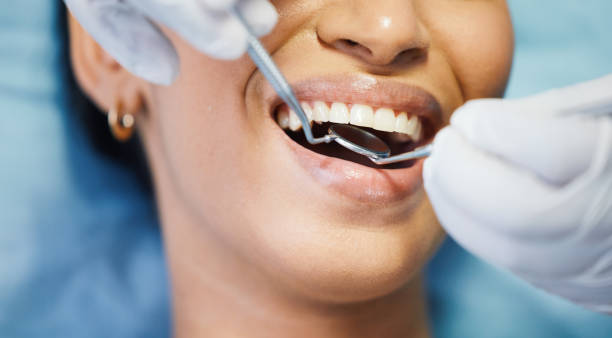 Best Emergency Denture Repair in New London, WI